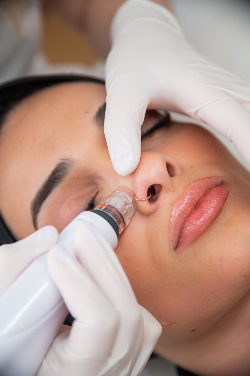 Hydrafacial Deluxe